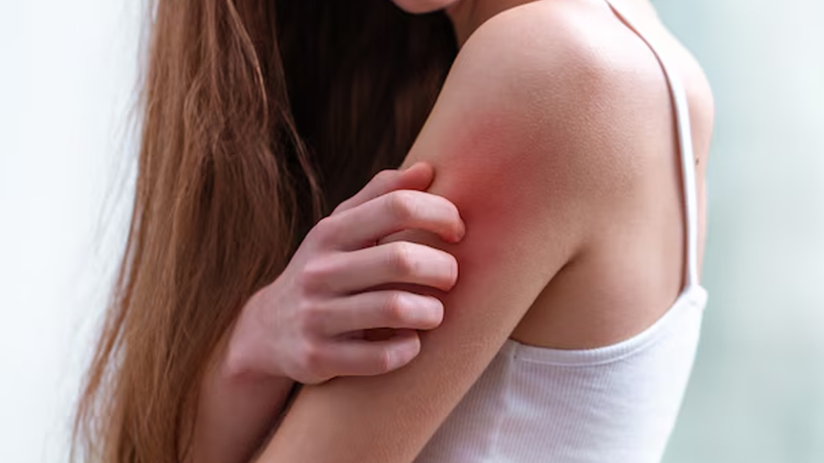 sharir-me-chinti-jaisa-katne-ke-karan-inside