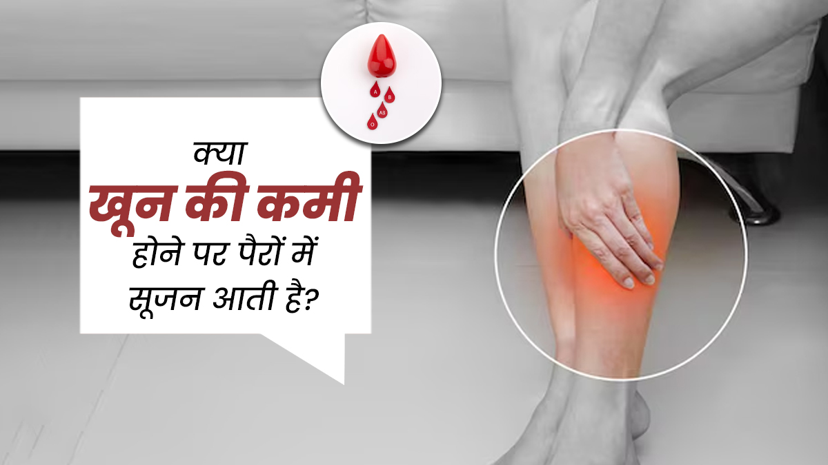 क्या पैरों में सूजन एनीमिया का लक्षण है? डॉक्टर से जानें सच्चाई