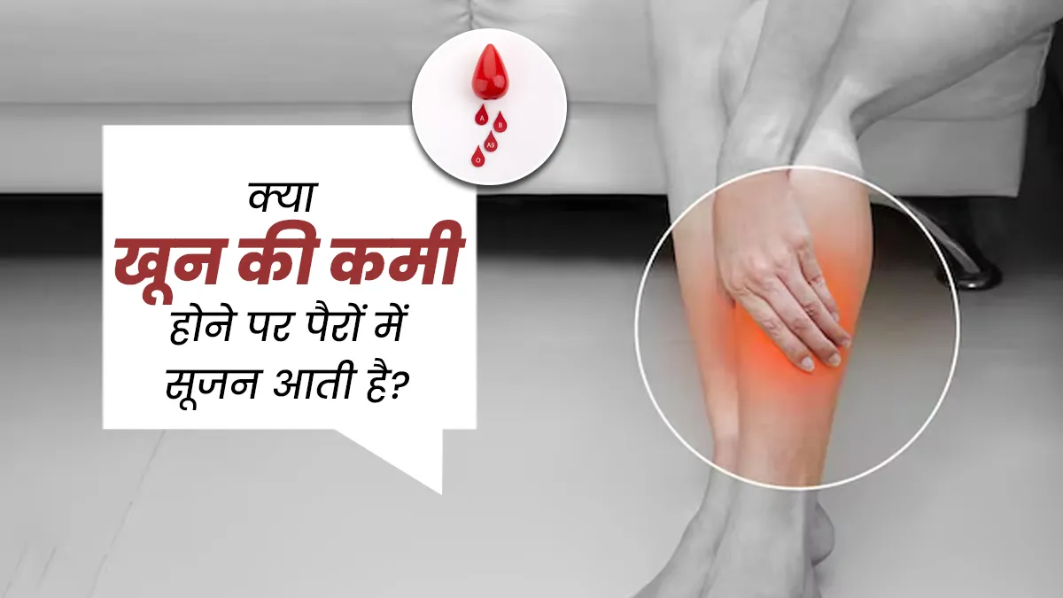 क्या पैरों में सूजन एनीमिया का लक्षण है? डॉक्टर से जानें सच्चाई