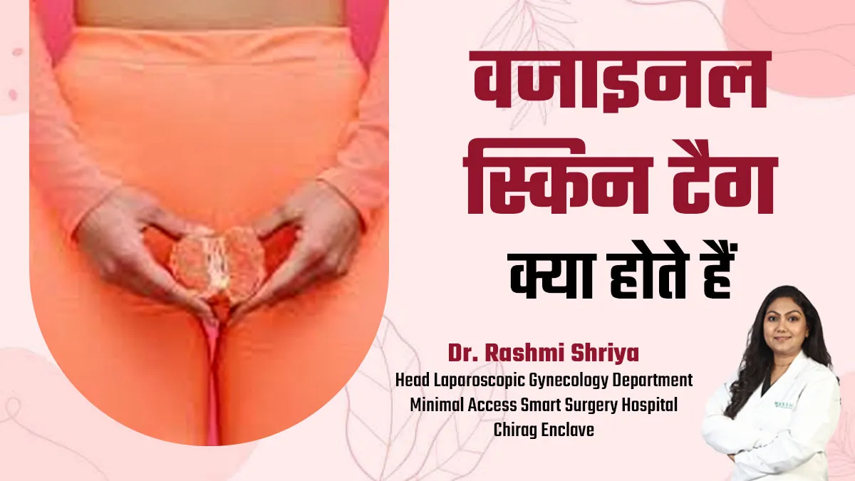 क्या होते हैं वजनाइल स्किन टैग? महिलाएं कैसे करें इनकी पहचान बता रही हैं डॉक्टर
