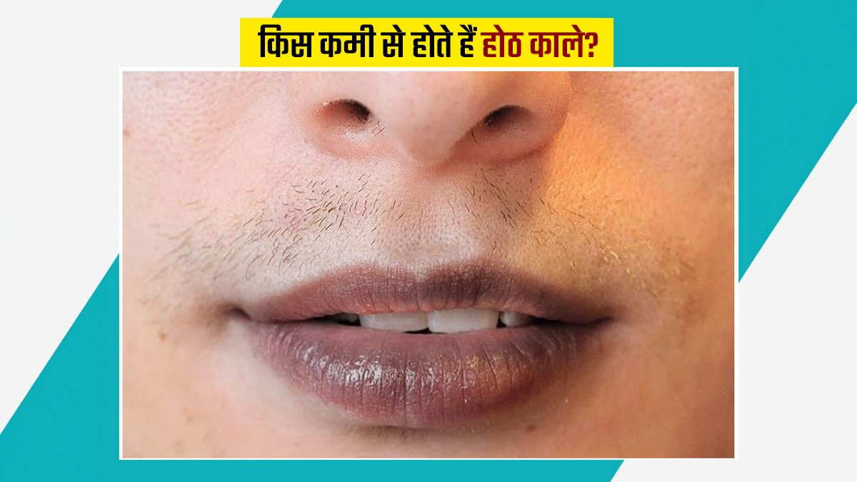 आपके होठ भी हैं काले? हो सकती हैं ये कमियां, न करें नजरअंदाज