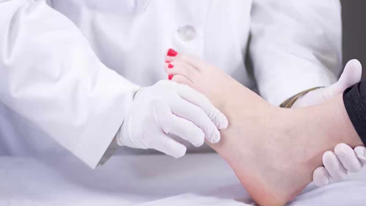 Is swelling in the legs a symptoms of anemia