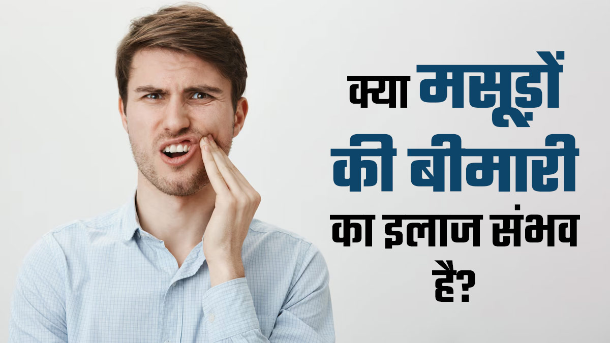क्या मसूड़ों की बीमारी का इलाज मुमकिन है? जानें पीरियडोंटल डिजीज के ट्रीटमेंट ऑप्शन