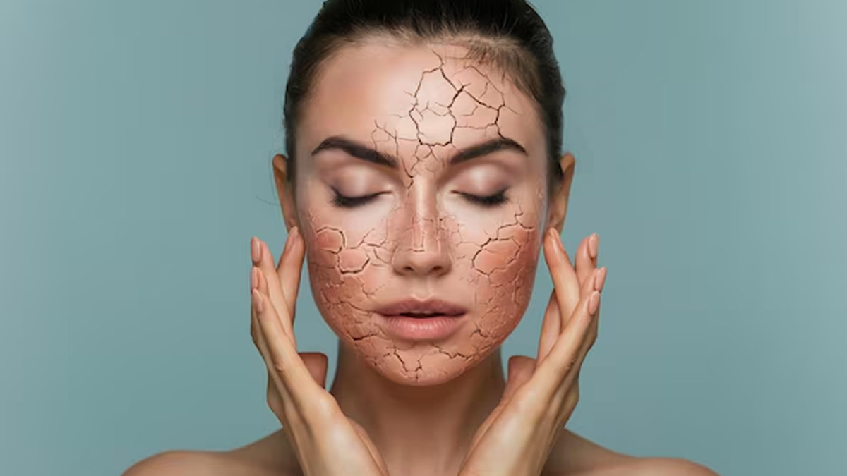 dry_skin_causes_pigmentation