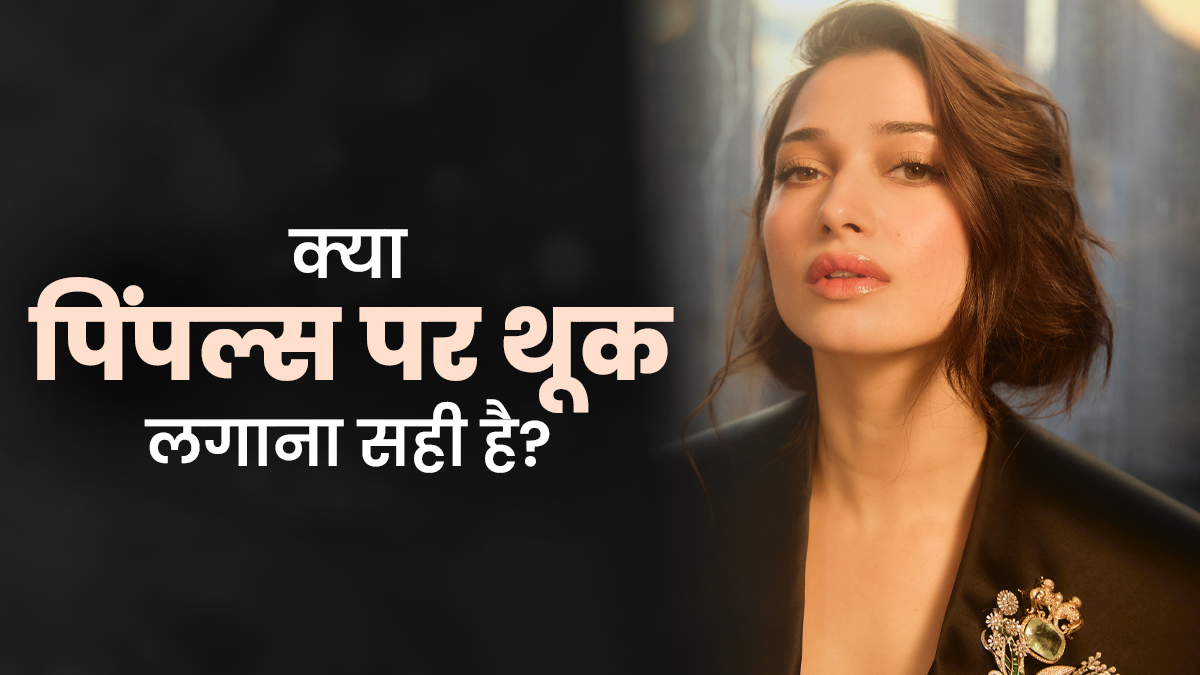 Tamannaah Bhatia लार से करती हैं पिंपल्स को ठीक, डॉक्टर से जानें ये कितना सही