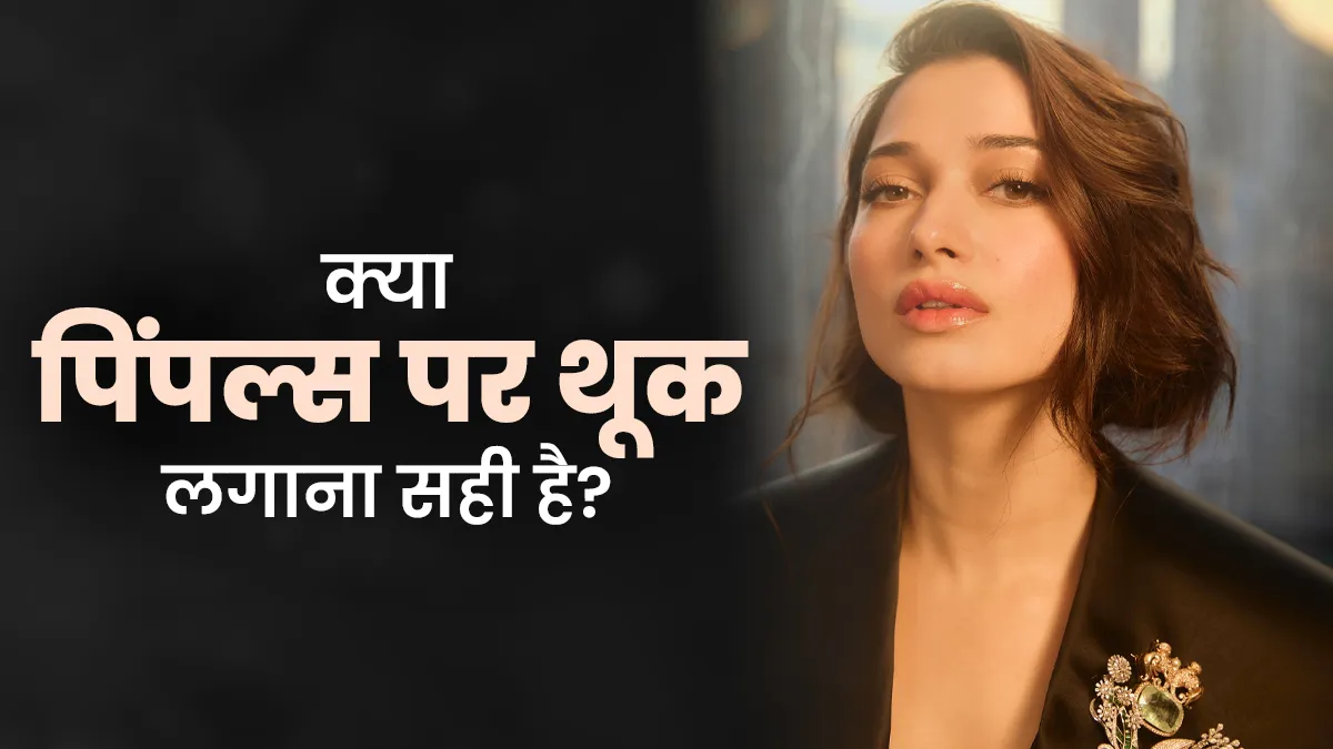 Tamannaah Bhatia लार से करती हैं पिंपल्स को ठीक, डॉक्टर से जानें ये कितना सही