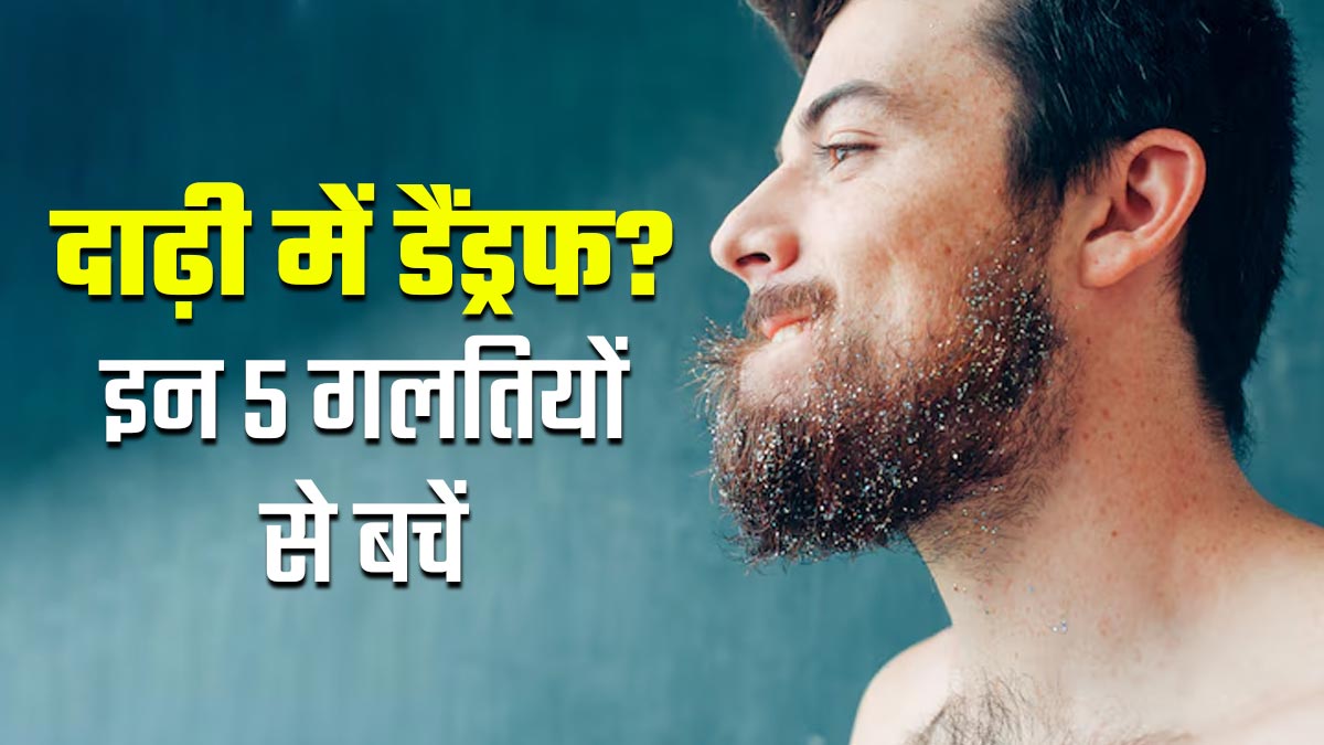 दाढ़ी रखने वाले सावधान! बारिश में डैंड्रफ बढ़ाने वाली ये 5 गलत‍ियां आज ही छोड़ें
