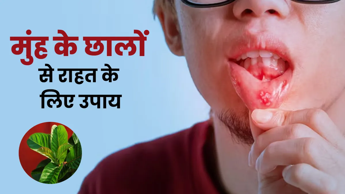 रातों-रात मुंह के छालों से मिलेगा छुटकारा करें इस हरे पत्ते का इस्तेमाल