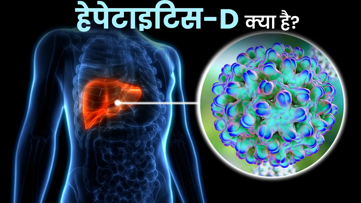 WHO ने हेपेटाइटिस-D को माना कैंसरकारक, जानें क्‍या है यह और इससे सुरक्षित रहने के उपाय