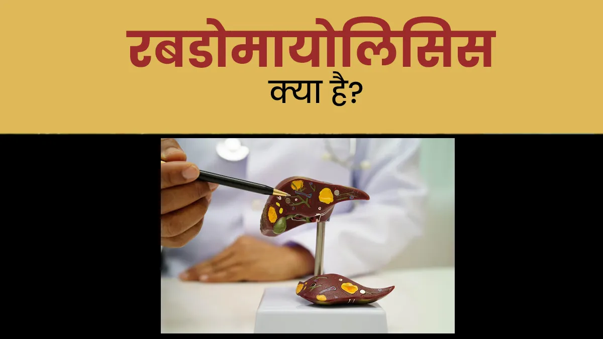 मांसपेशियों के टूटने की खतरनाक स्थिति है रबडोमायोलिसिस, जानें लक्षण और बचाव