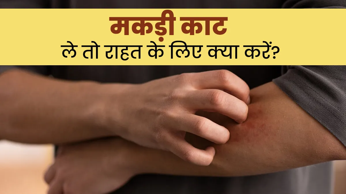 मकड़ी काट ले तो भूलकर भी न करें नजरअंदाज, जल्द से जल्द करें ये एक काम
