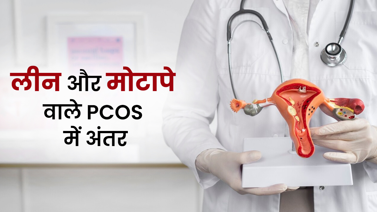लीन और मोटापे वाले PCOS में क्या अंतर है? डॉक्टर से जानें