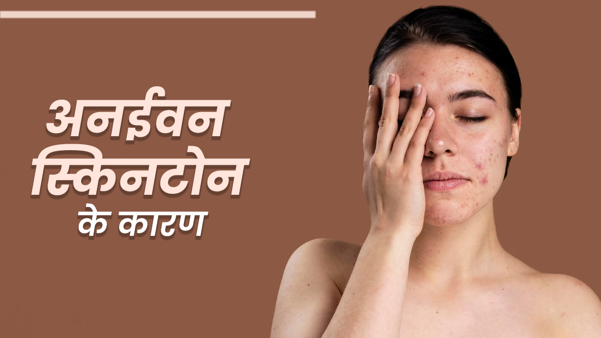 अनईवन स्किनटोन के लिए जिम्मेदार हो सकते हैं ये 5 कारण, एक्सपर्ट से जानें इसका ट्रीटमेंट