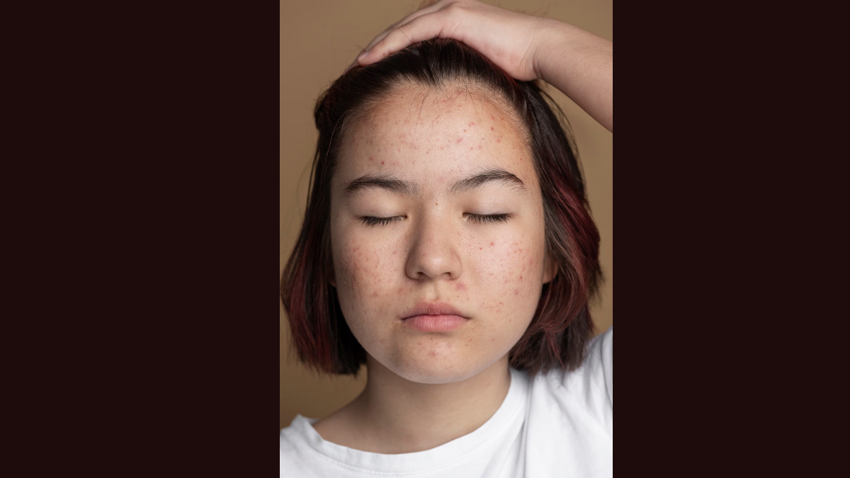 uneven skin tone reason