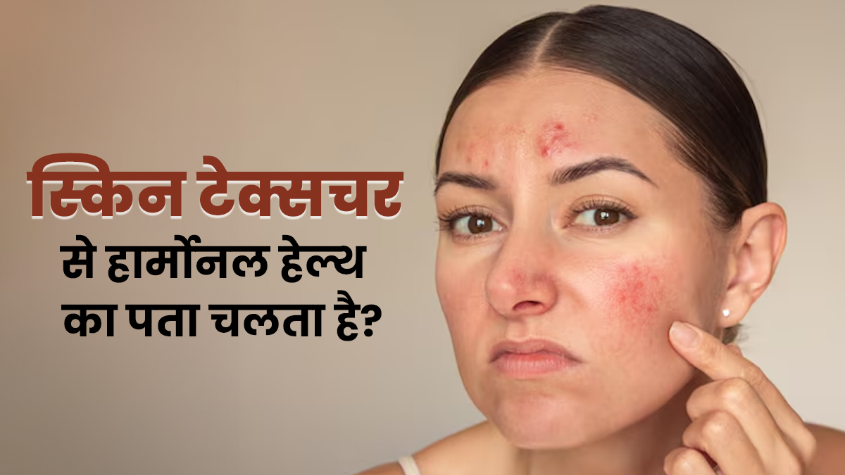 क्या स्किन टेक्सचर से हार्मोनल हेल्थ का पता चलता है? एक्सपर्ट से जानें