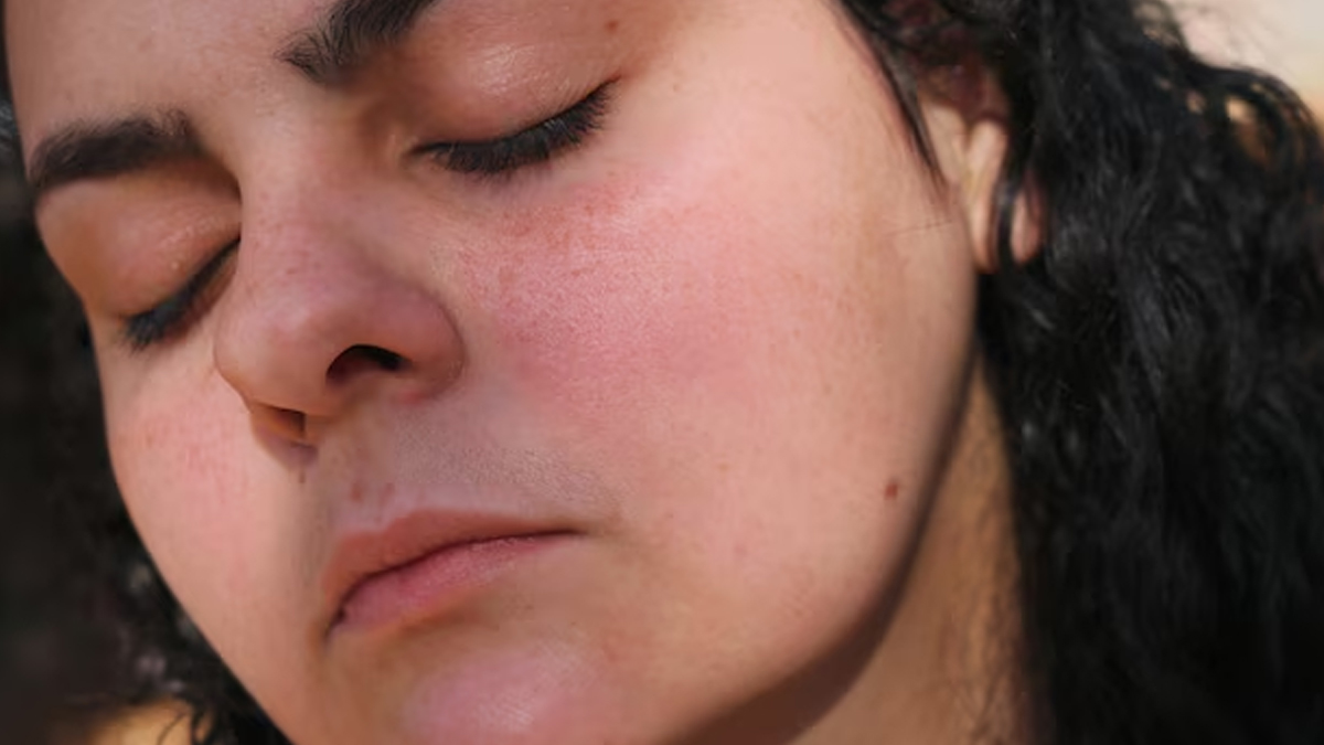 skin-texture-and-hormonal-health