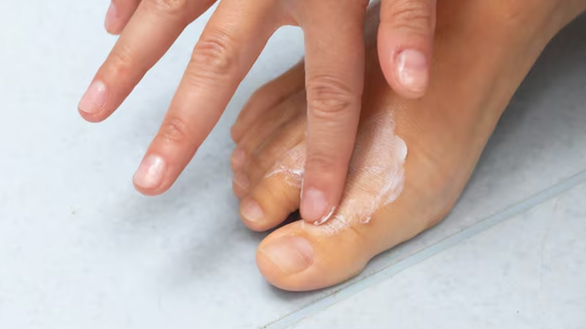 Foot-fungal-infection-symptoms
