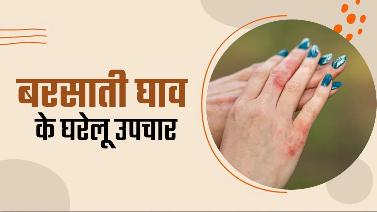 निकल रहे हैं शरीर पर फफोले और बड़े-बड़े दाने? आयुर्वेदाचार्य से जानें इस बरसाती घाव के घरेलू उपचार