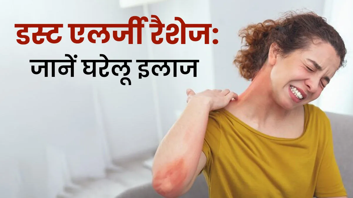 डस्‍ट एलर्जी से हुए रैशेज से जल्‍द पाएं छुटकारा, अपनाएं ये 5 घरेलू उपाय