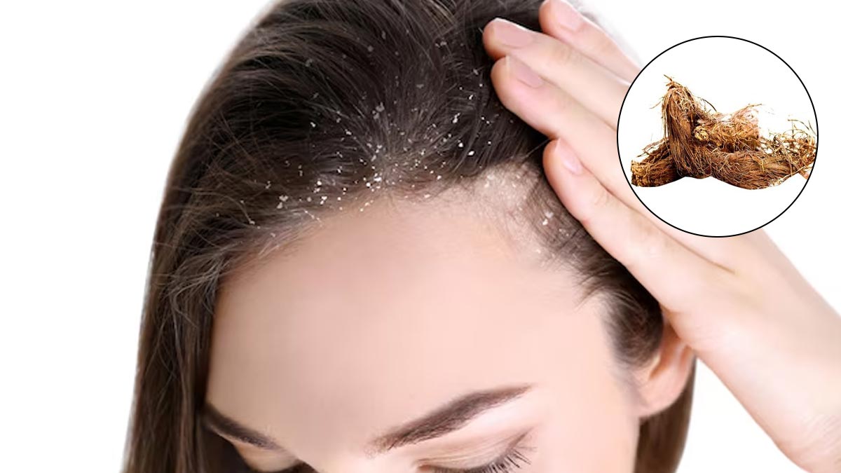 सिर में हाथ डालते ही झड़ने लगता है डैंड्रफ? तेल में खौलाकर लगाएं ये जड़ी बूटी