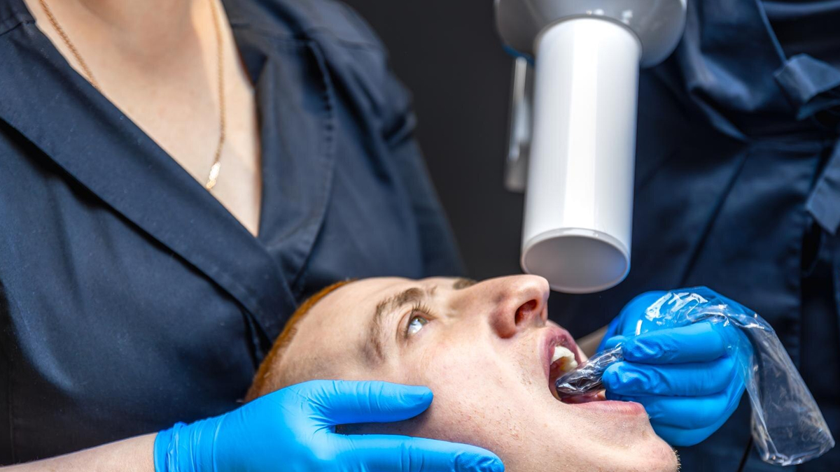 non smoker get mouth cancer expert advice