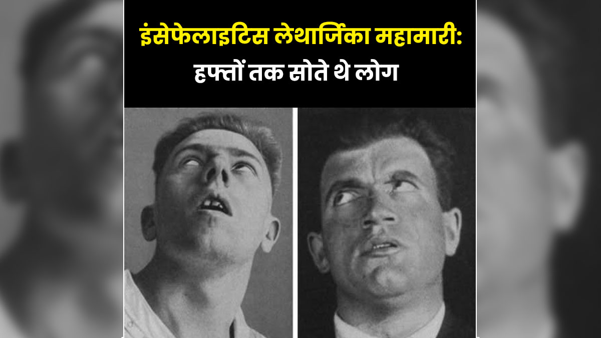 क्‍या है 1915 में फैली रहस्यमयी बीमारी इंसेफेलाइटिस लेथार्जिका? ज‍िसमें हफ्तों तक सोते थे लोग