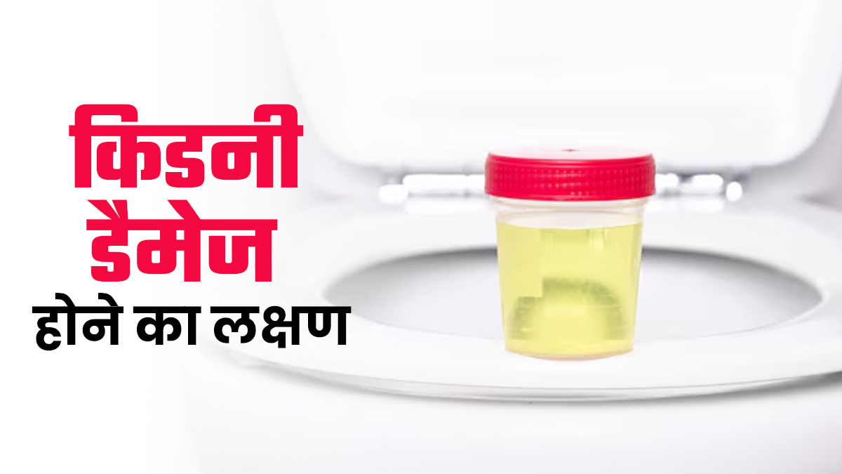 किडनी डैमेज होने से पेशाब कैसे आता है? इन 5 बदलावों पर दें ध्यान