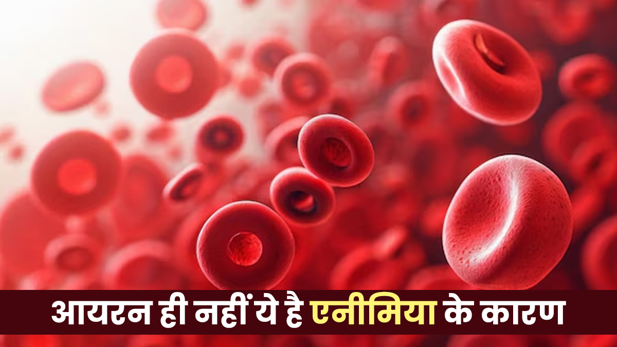 आयरन ही नहीं, इन कारणों से भी शरीर में हो सकती है खून की कमी