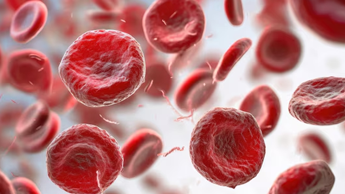 what causes anemia if not iron deficiency in hindi 02