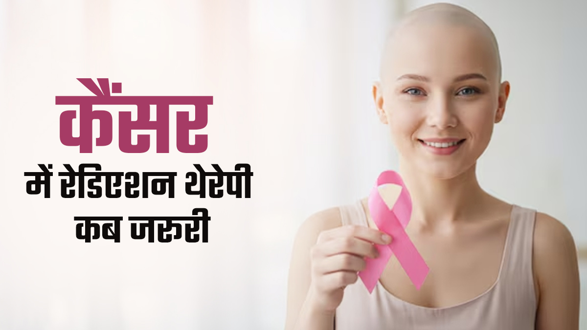 कैंसर के इलाज में रेडिएशन थेरेपी कब जरूरी होती है? डॉक्टर से जानें