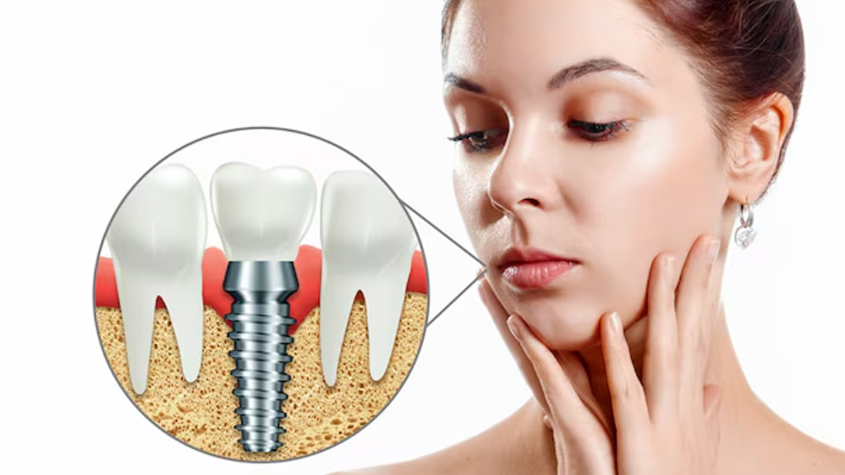 can sugar patient implant teeth 01 (7)