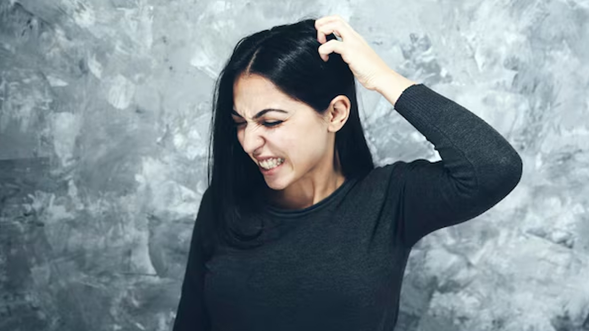 Home-Remedies-for-Itchy-Scalp-inside