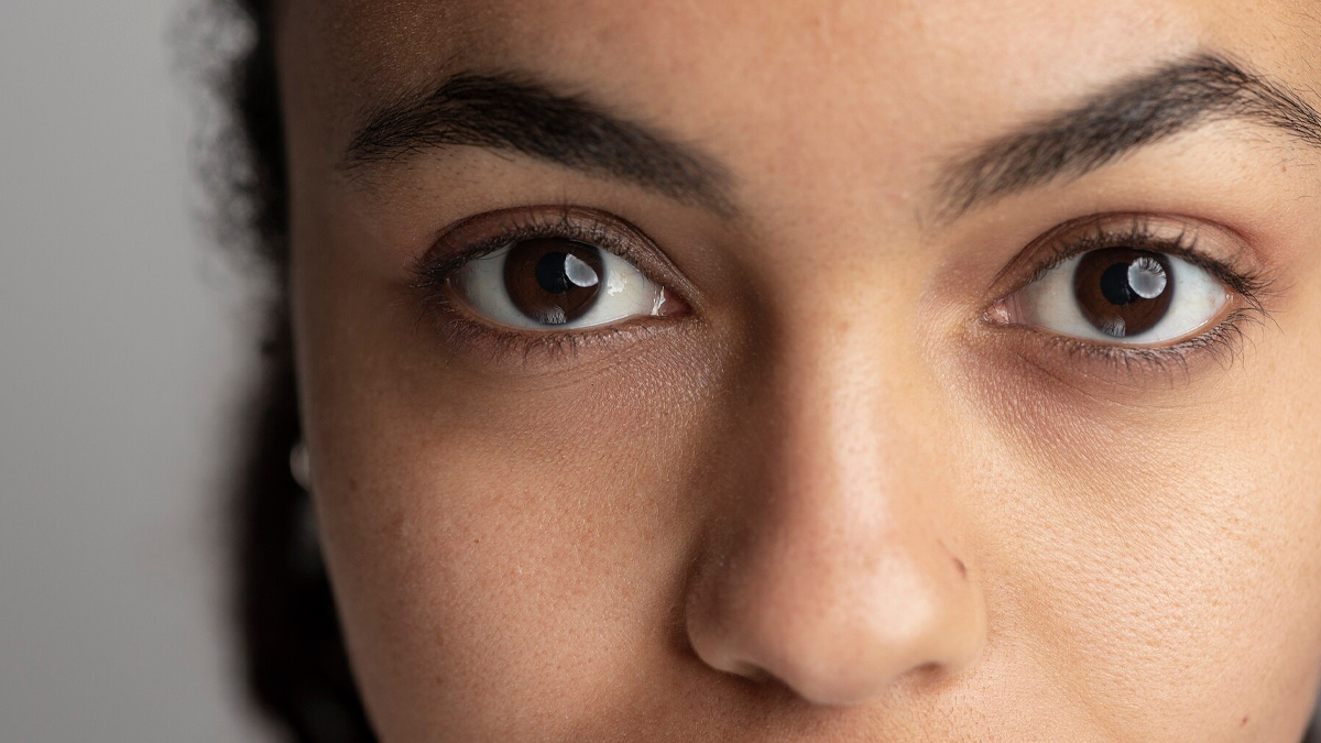 does sleeping make dark circles worse in hindi 1