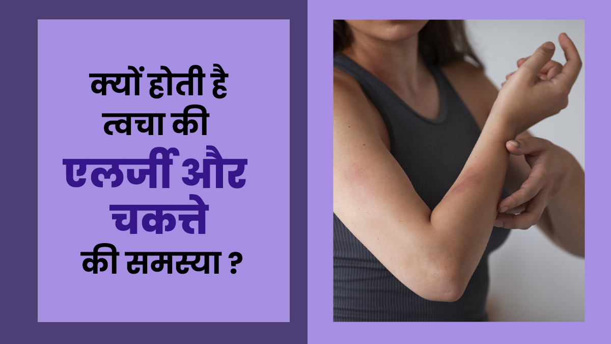खराब स्किन केयर ही नहीं, ये 6 समस्याएं भी हो सकते हैं स्किन एलर्जी और रैशेज होने का कारण
