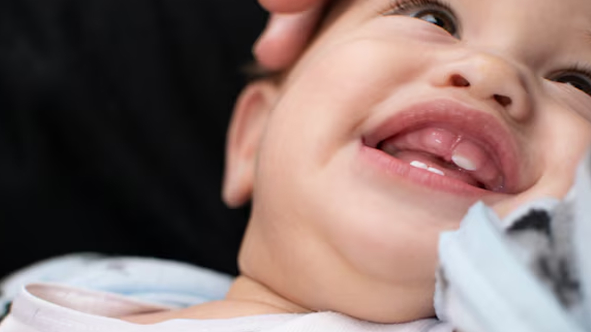 what causes delay in baby teeth in hindi 01 (5)