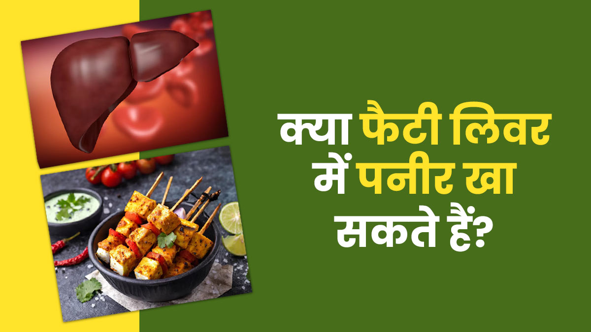 Fatty Liver: क्या फैटी लिवर में पनीर खा सकते हैं? जानें डायटिशियन से