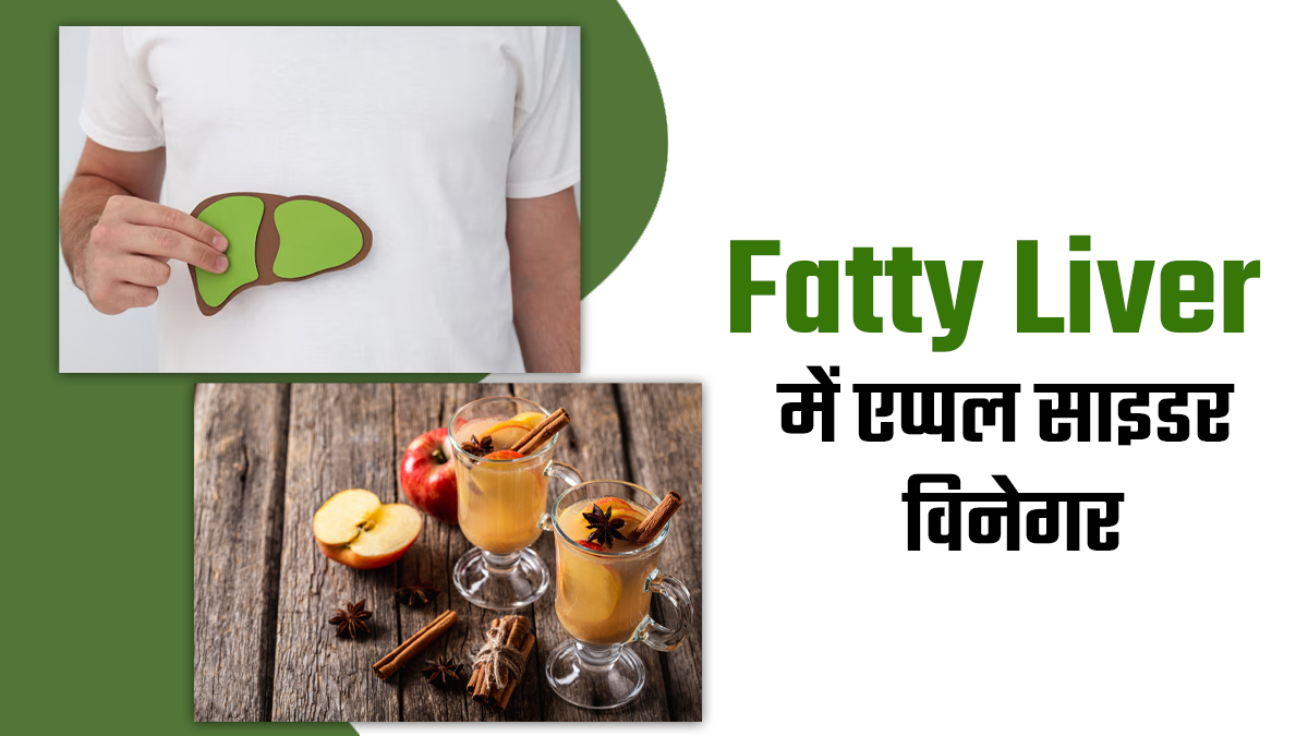 फैटी लिवर में एप्पल साइडर विनेगर पीने से मिलते हैं ये 3 बेहतरीन फायदे, एक्सपर्ट बता रहे हैं इनके बारे में