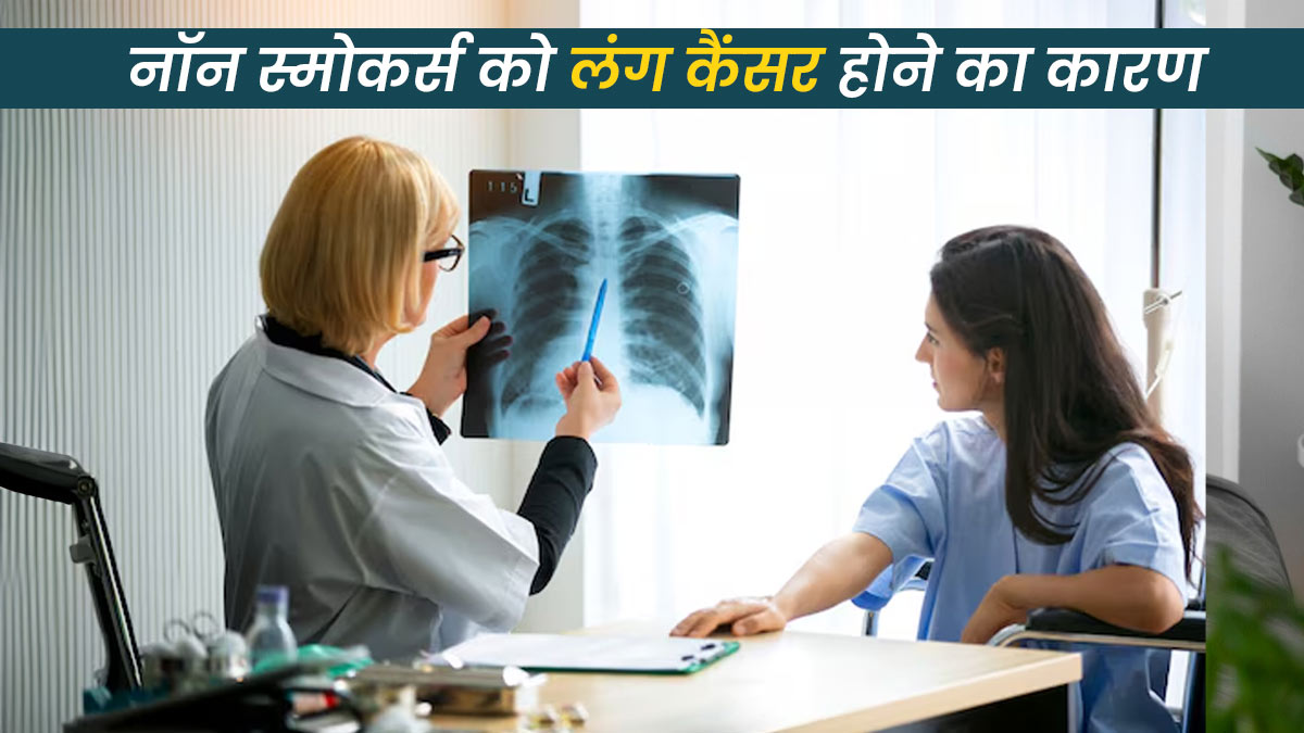 नॉन स्मोकर्स को क्यों हो रहा है लंग कैंसर? जानें डॉक्टर से इसके कारण