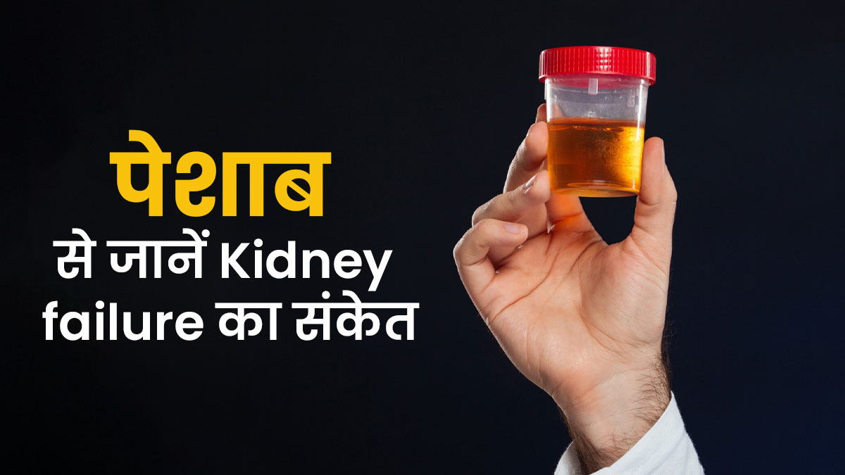किडनी फेल होने में पेशाब किस रंग का होता है? Urologist से जानें यूरिन से Kidney failure का संकेत