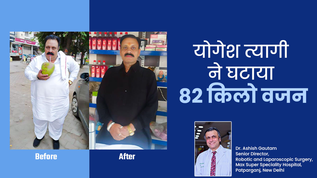 170 किलो के योगेश त्यागी ने घटाया 82 किलो वजन, जानिए फैट टू फिट की रियल जर्नी