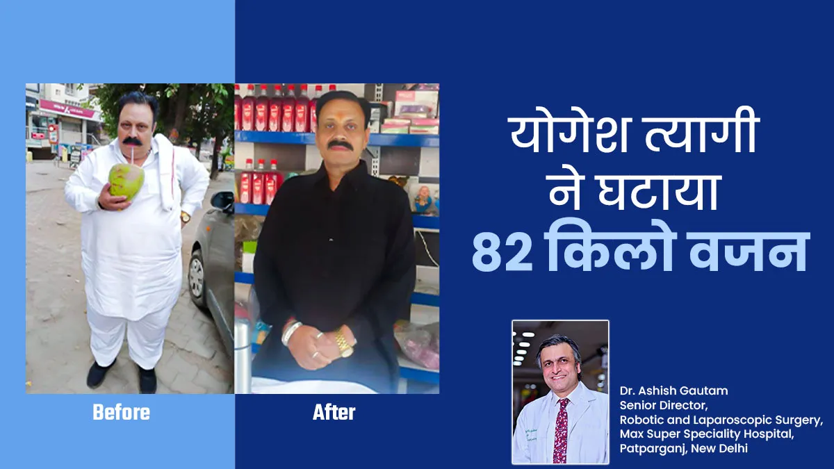 170 किलो के योगेश त्यागी ने घटाया 82 किलो वजन, जानिए फैट टू फिट की रियल जर्नी