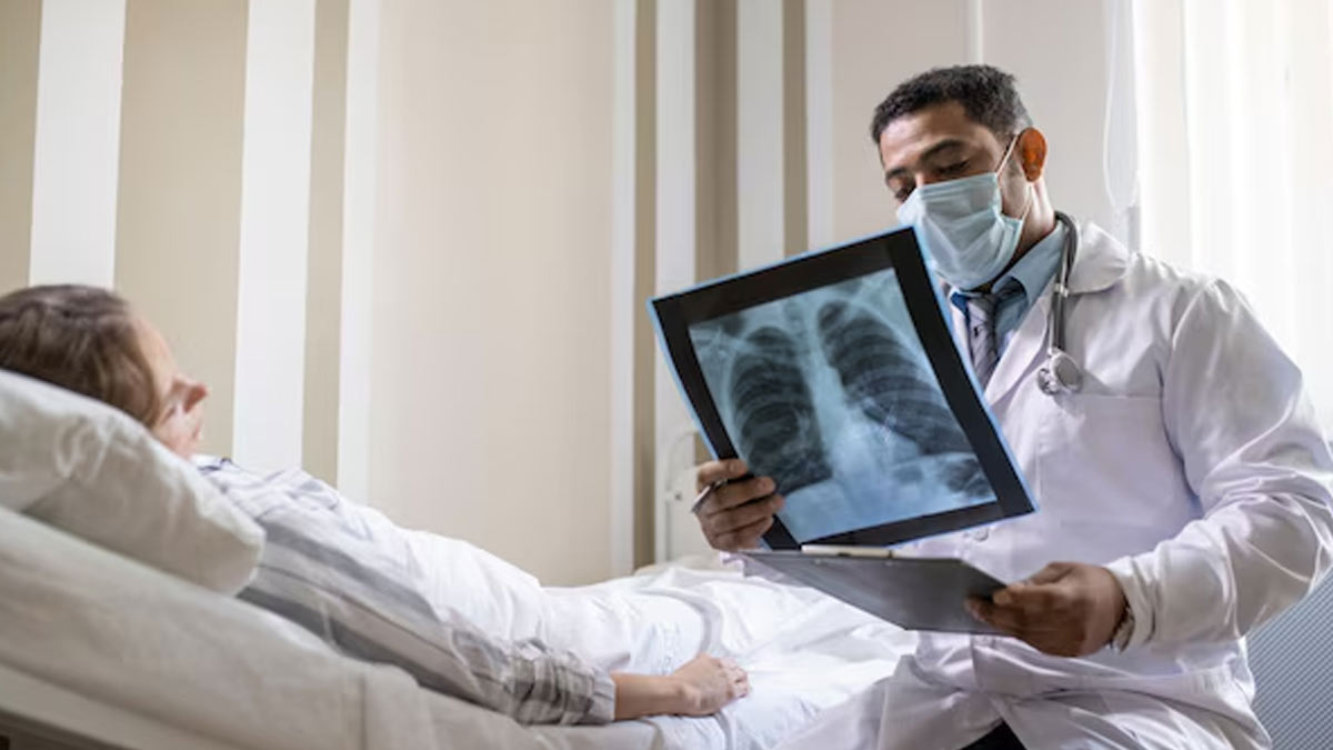 non smokers can cause lung cancer expert advice