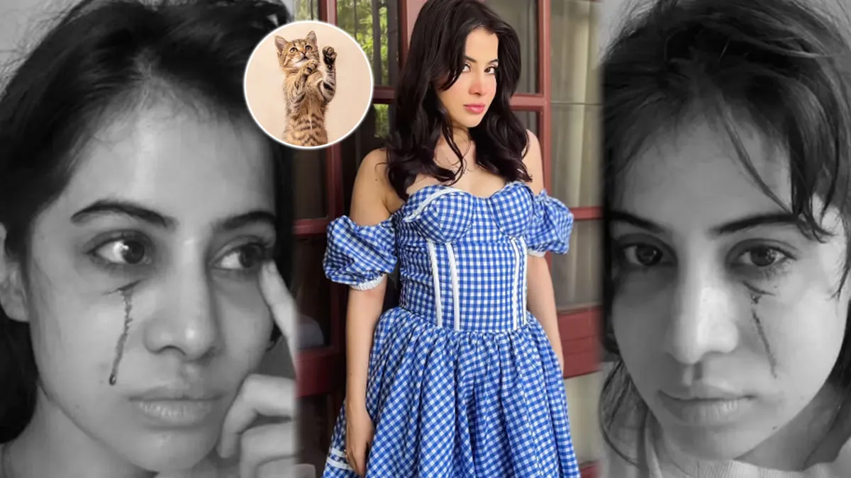 Urfi Javed को बिल्ली ने किया लहूलुहान? जानें बिल्ली के पंजा मारने पर क्या करें