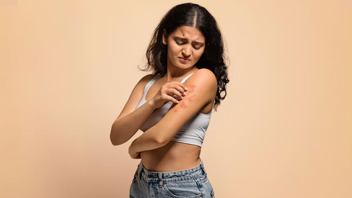 क्या आपको भी होती है पित्ती में खुजली? जानें ऐसा क्यों नहीं करना चाहिए