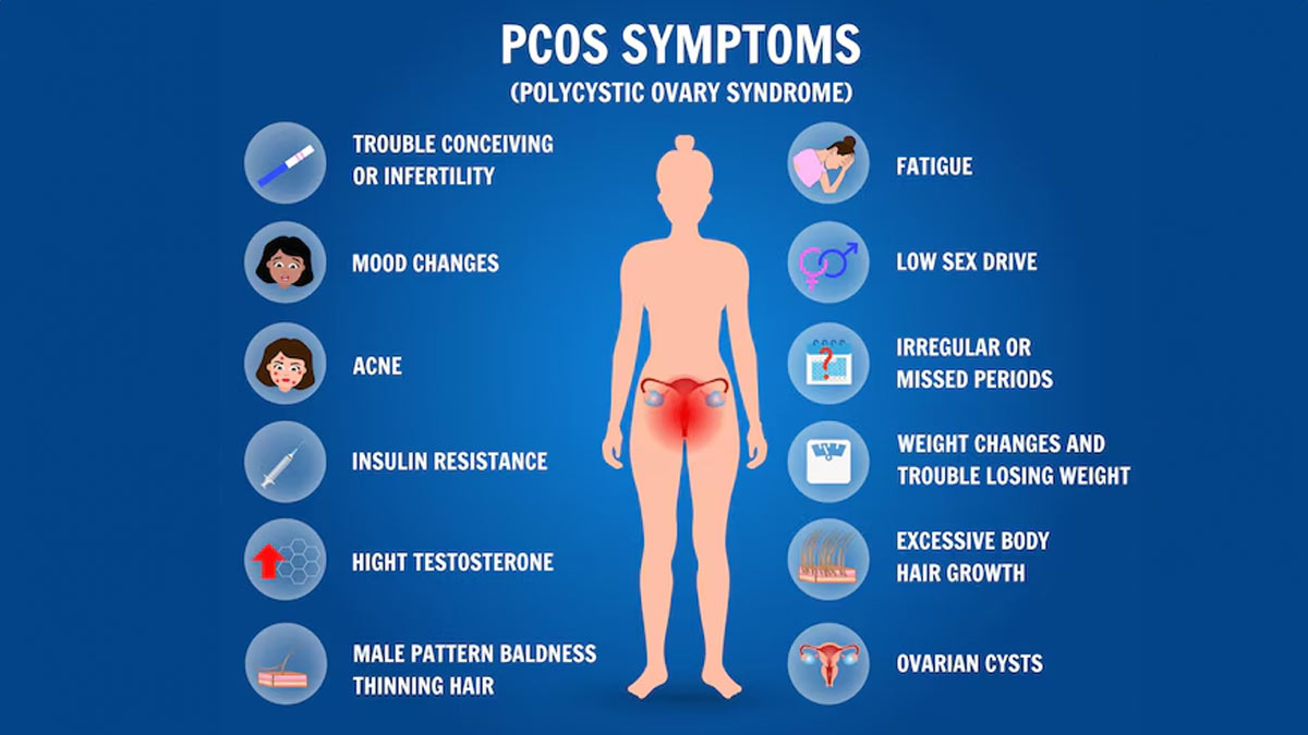 PCOS-symptoms-in-hindi