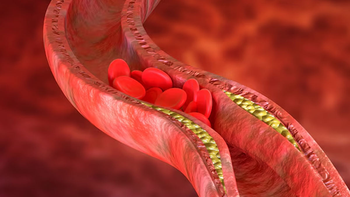 bhune_chane_in_high_cholesterol