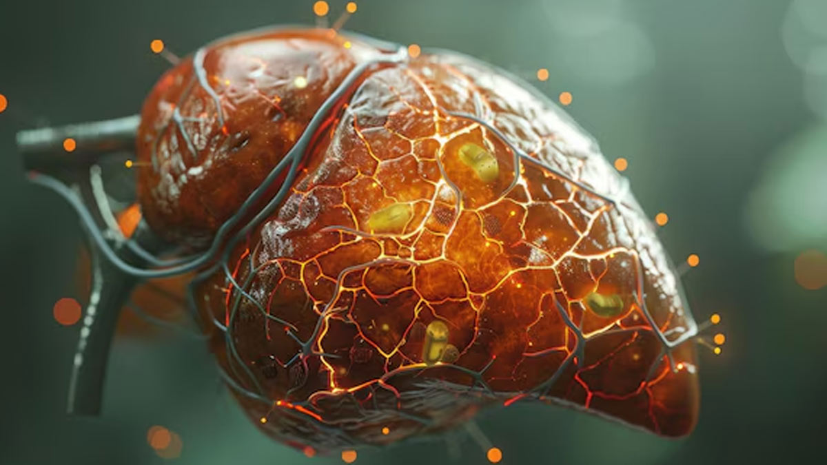 habits-to-reverse-fatty-liver