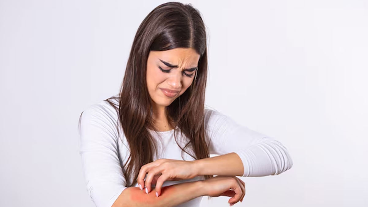 what happens if you itch hives 01 (7)