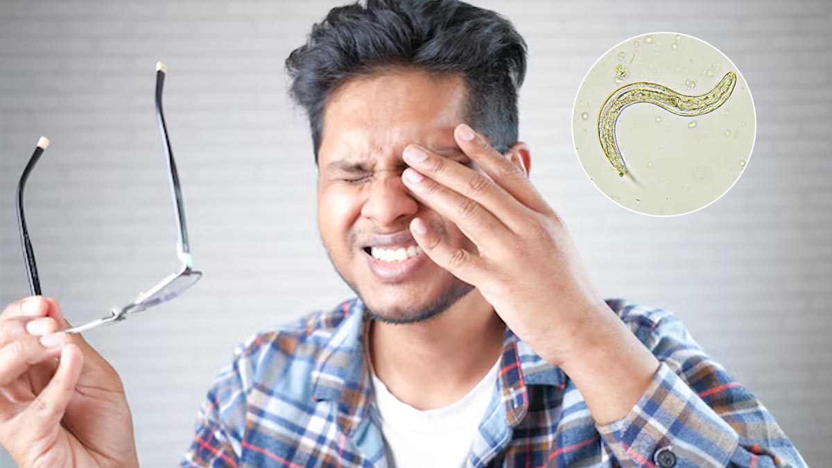 आंख में कीड़ा घुसने से चली गई आंखों की रोशनी, स्टडी में सामने आया चौकाने वाला कारण