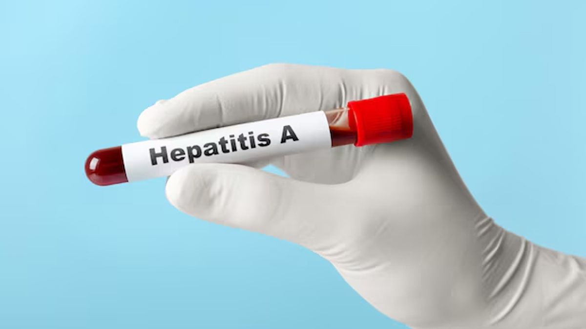 Hepatitis